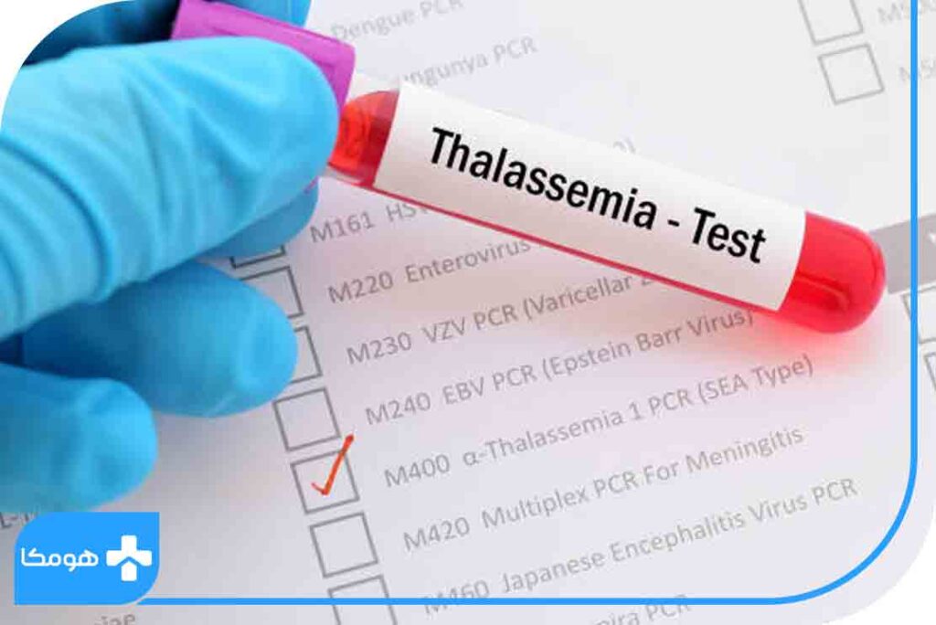 تالاسمی چیست؟ آیا بیماری تالاسمی خطرناک است؟ مجله هومکا